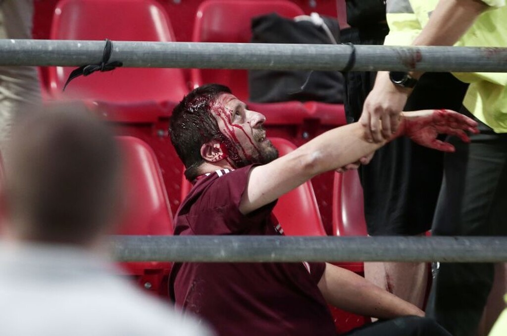 Εικόνες – σοκ από τα επεισόδια στου Ρέντη