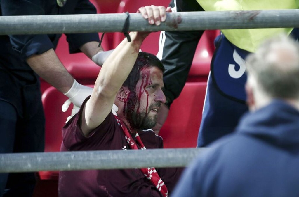 Εικόνες – σοκ από τα επεισόδια στου Ρέντη