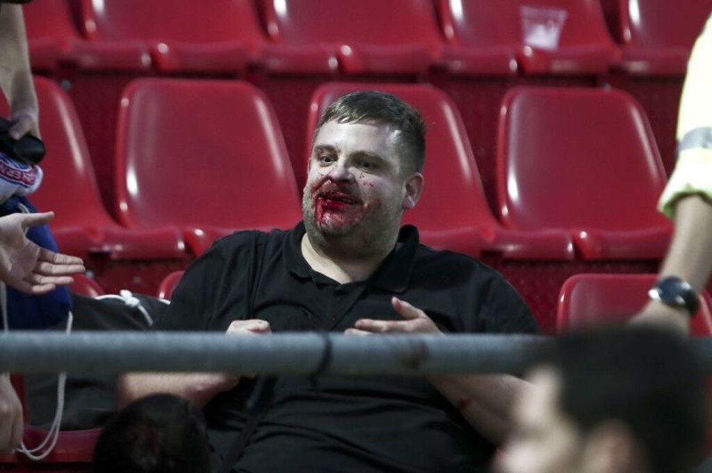 Εικόνες – σοκ από τα επεισόδια στου Ρέντη