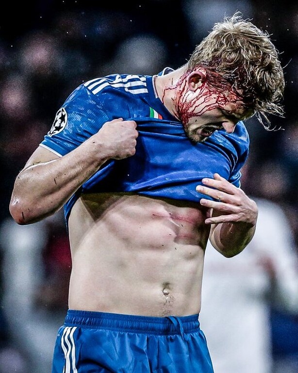Champions League: Σοκάρει το ματωμένο κεφάλι του Ντε Λιχτ (video+photos)