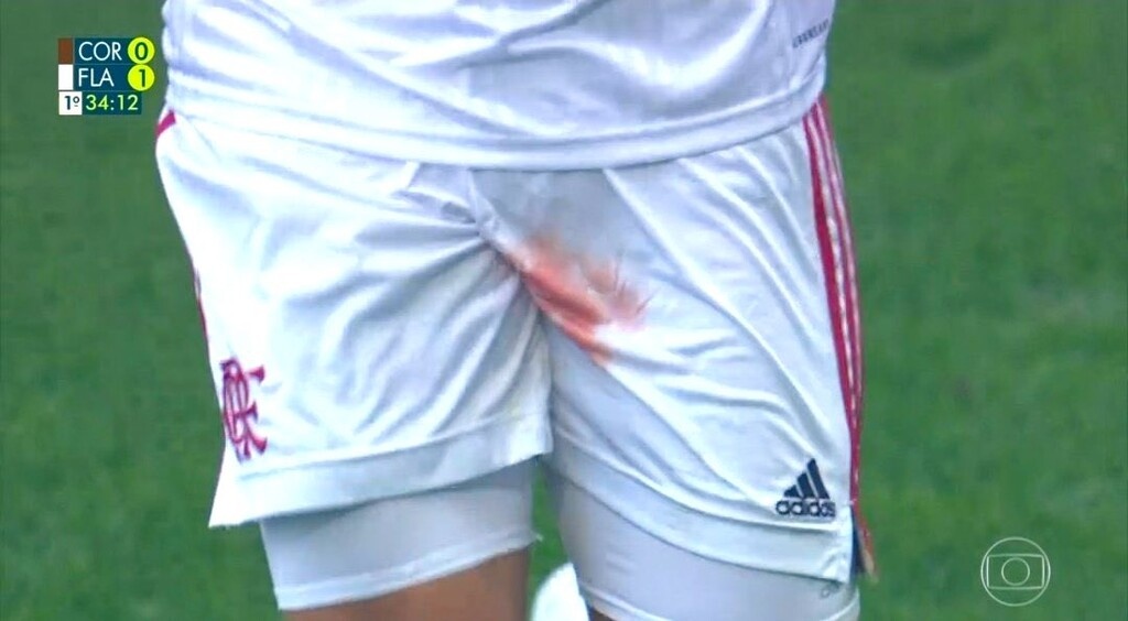 Φρικτός τραυματισμός ποδοσφαιριστή, αιμορραγούσε στα γεννητικά όργανα (video+photos)