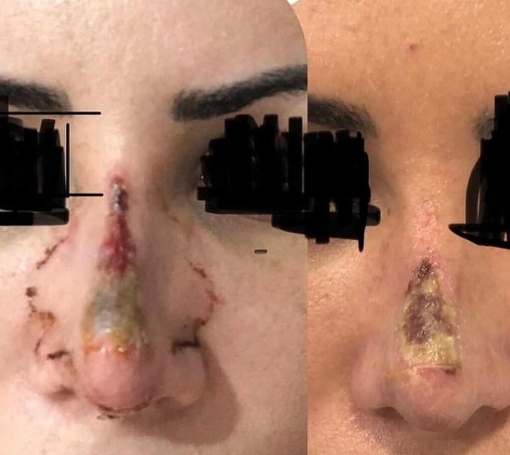 Σκάνδαλο: Πρώην διαιτητής άλλαξε καριέρα - Κατηγορείται για σοβαρά ιατρικά λάθη (photos)