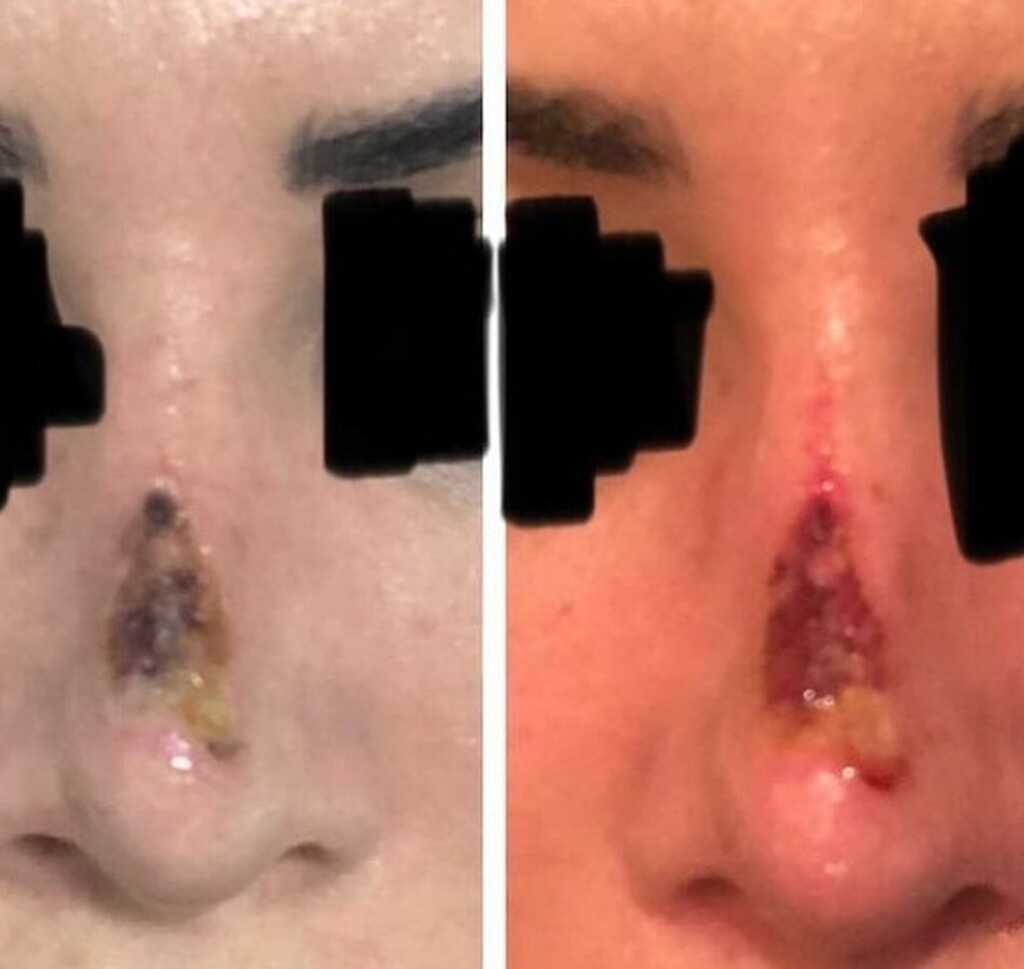 Σκάνδαλο: Πρώην διαιτητής άλλαξε καριέρα - Κατηγορείται για σοβαρά ιατρικά λάθη (photos)