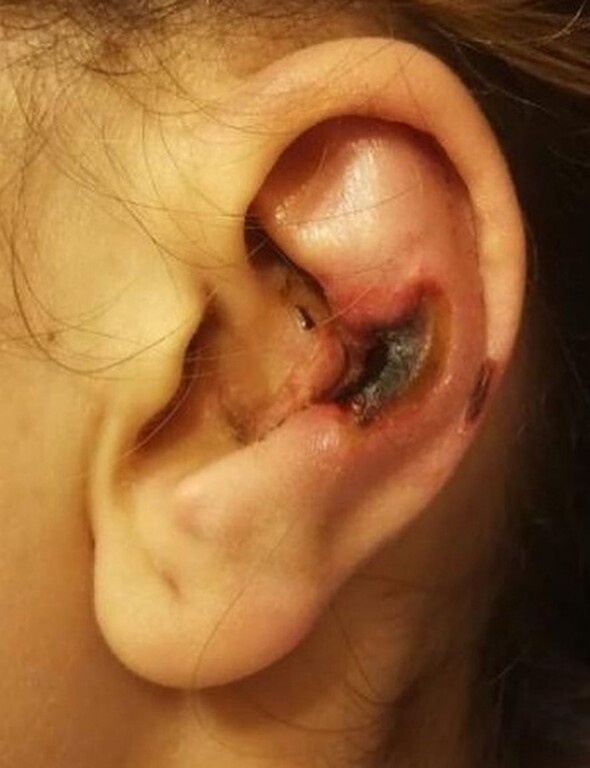 Σκάνδαλο: Πρώην διαιτητής άλλαξε καριέρα - Κατηγορείται για σοβαρά ιατρικά λάθη (photos)