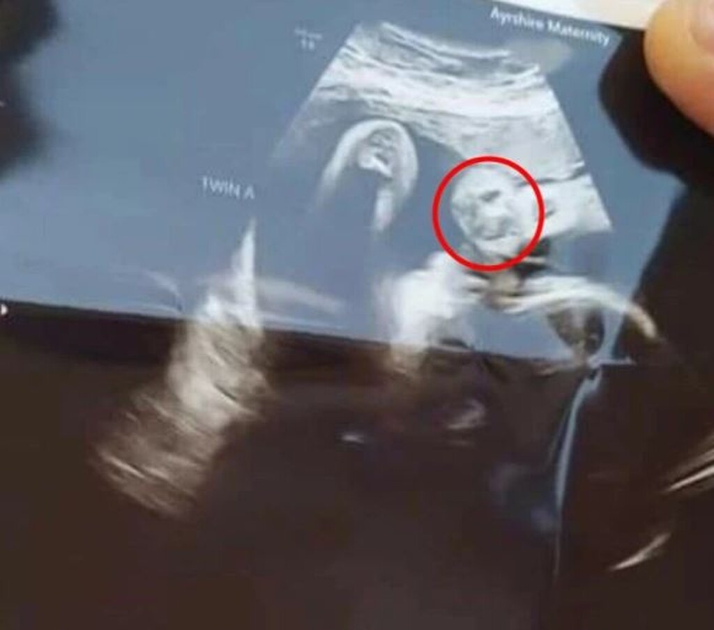 Έγκυος πήγε για υπερηχογράφημα - Φρίκαρε μ’ αυτό που είδε (photos+video)