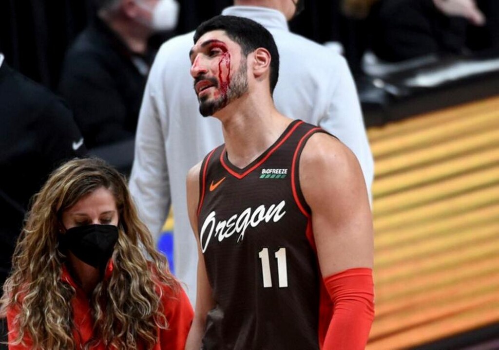 NBA: Μάτωσε... από συμπαίκτη ο Καντέρ (photos+video)