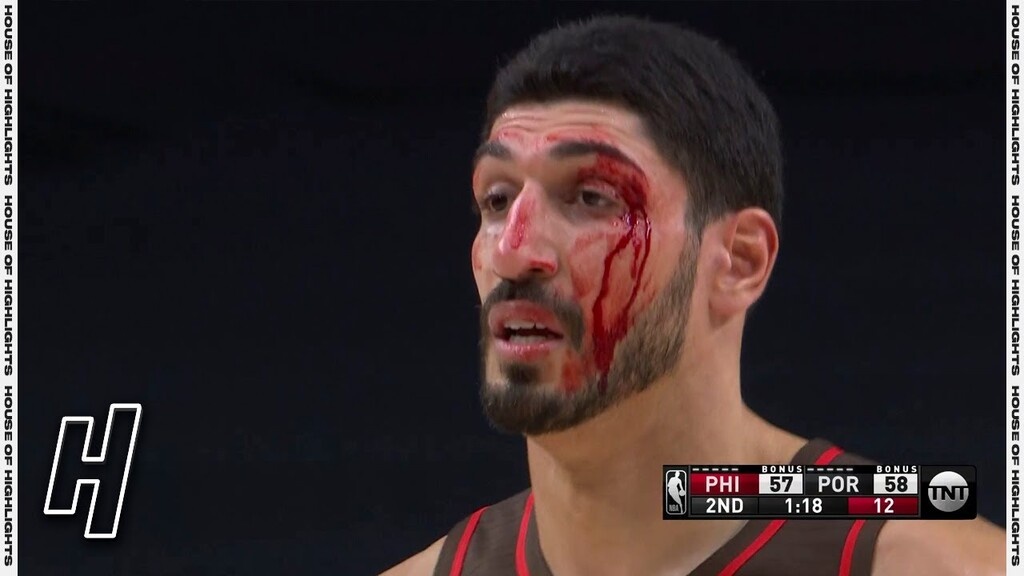 NBA: Μάτωσε... από συμπαίκτη ο Καντέρ (photos+video)