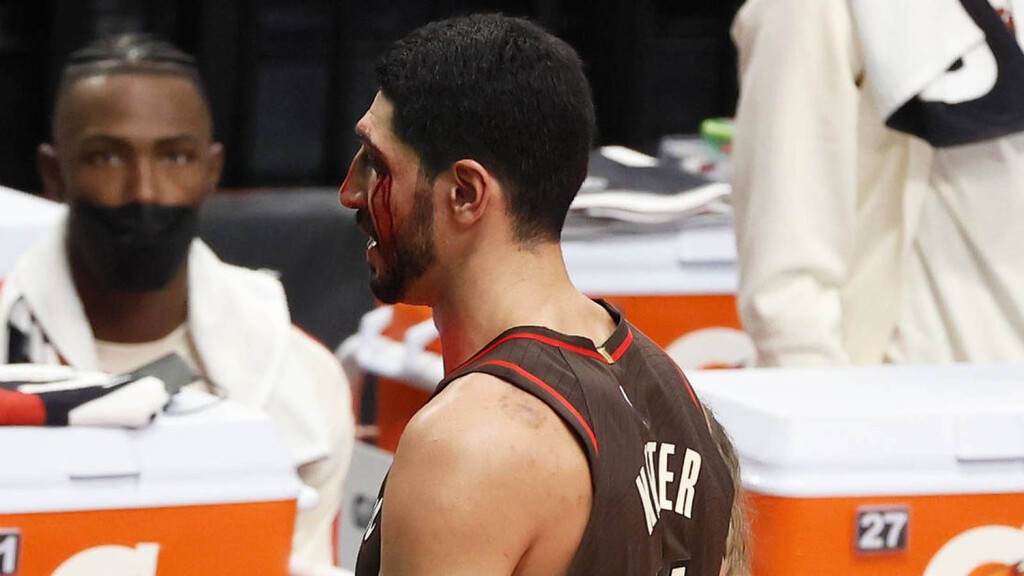 NBA: Μάτωσε... από συμπαίκτη ο Καντέρ (photos+video)