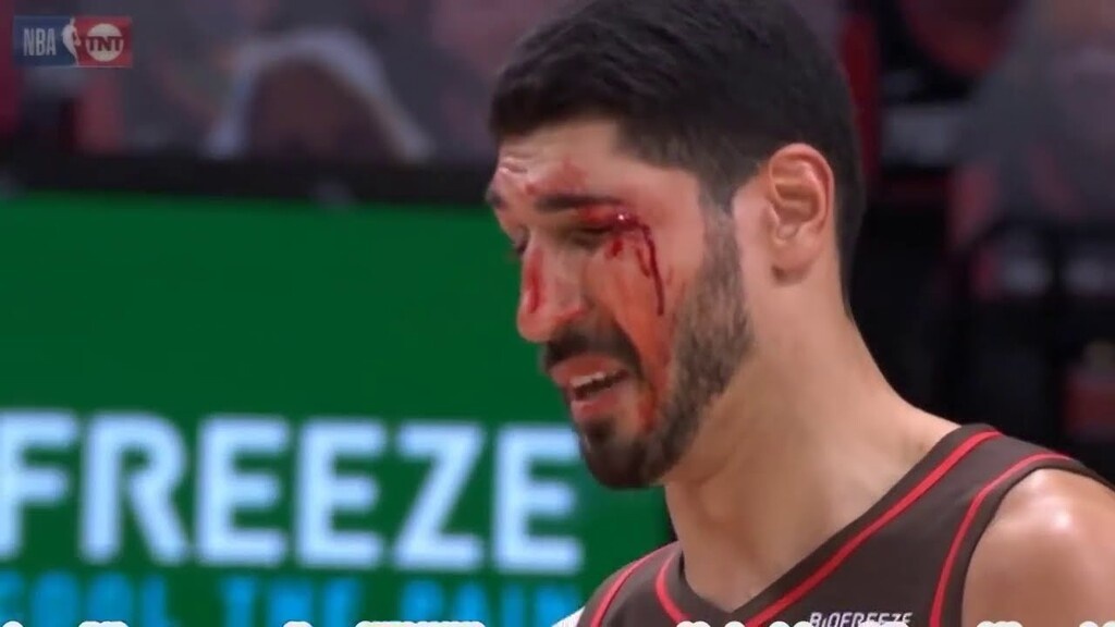 NBA: Μάτωσε... από συμπαίκτη ο Καντέρ (photos+video)