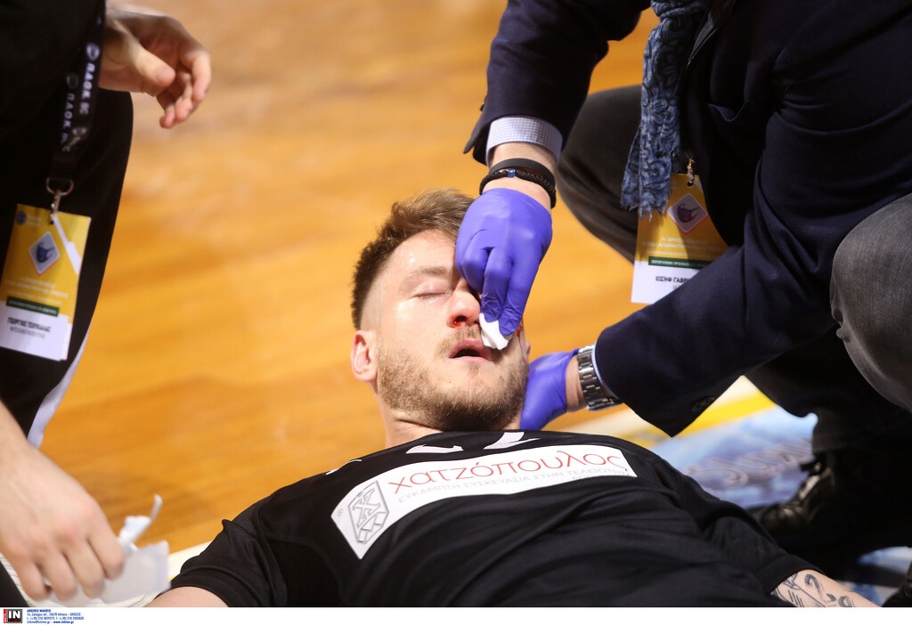 Απίστευτος τραυματισμός στο Άρης-ΠΑΟΚ: Αποχώρησε με αίματα στο πρόσωπο ο Παπαντωνίου (video+photos)