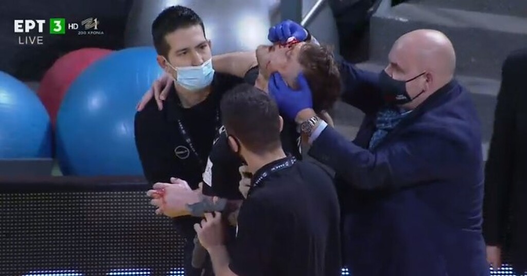 Απίστευτος τραυματισμός στο Άρης-ΠΑΟΚ: Αποχώρησε με αίματα στο πρόσωπο ο Παπαντωνίου (video+photos)
