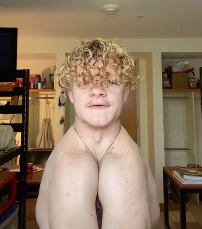 Νεαρός χτυπά παλαμάκια με τους ώμους του - Πάσχει από σπάνια πάθηση (photos+video)