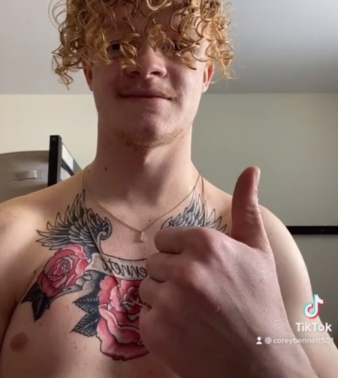 Νεαρός χτυπά παλαμάκια με τους ώμους του - Πάσχει από σπάνια πάθηση (photos+video)