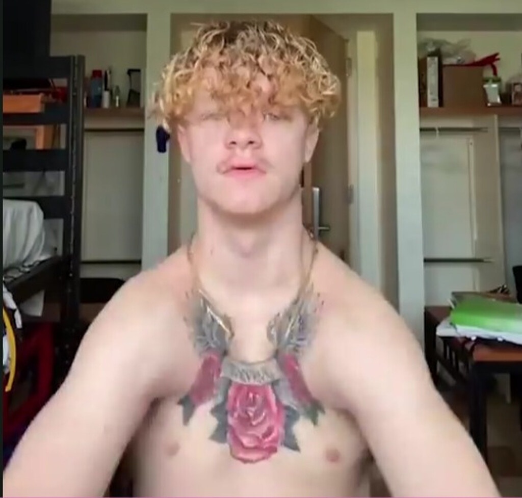 Νεαρός χτυπά παλαμάκια με τους ώμους του - Πάσχει από σπάνια πάθηση (photos+video)