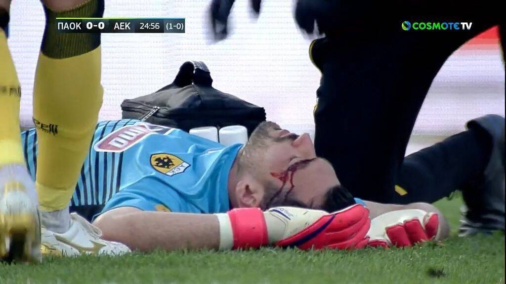 ΠΑΟΚ-ΑΕΚ: Απίθανη διπλή επέμβαση από τον... αιμόφυρτο Τσιντώτα (video+photos)