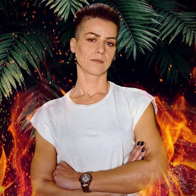 Survivor: Βγήκε από το παιχνίδι και έκανε χειρουργείο - Η κίνηση της παραγωγής (photos+video)