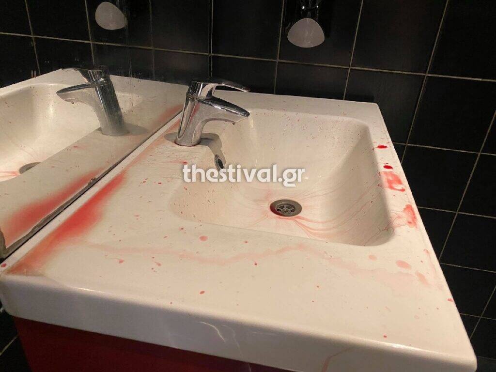 Νέο επεισόδιο στη Θεσσαλονίκη με οπαδική χροιά – 30 άτομα με ρόπαλα επιτέθηκαν σε παρέα (photos)