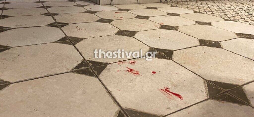 Νέο επεισόδιο στη Θεσσαλονίκη με οπαδική χροιά – 30 άτομα με ρόπαλα επιτέθηκαν σε παρέα (photos)