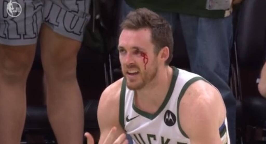 Μιλγουόκι Μπακς - Μπρούκλιν Νετς: Μάτωσε ο Κόνατον από αγκωνιά (video+photos)