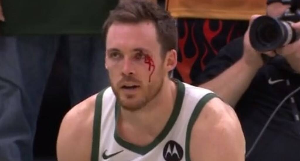 Μιλγουόκι Μπακς - Μπρούκλιν Νετς: Μάτωσε ο Κόνατον από αγκωνιά (video+photos)