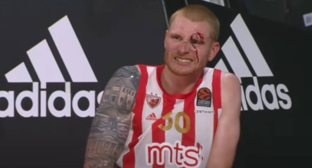 Ερυθρός Αστέρας: Πετυχημένη επέμβαση για Ουάιτ (photos)