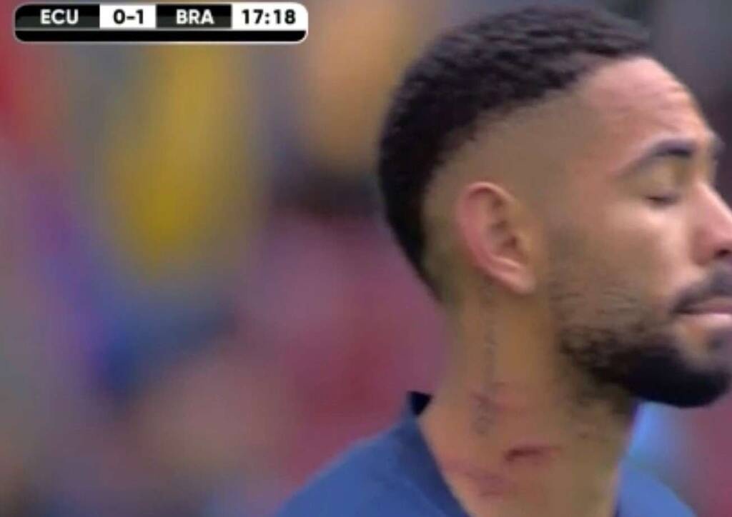 Βραζιλία: Ο… σημαδεμένος Κούνια (Photos)