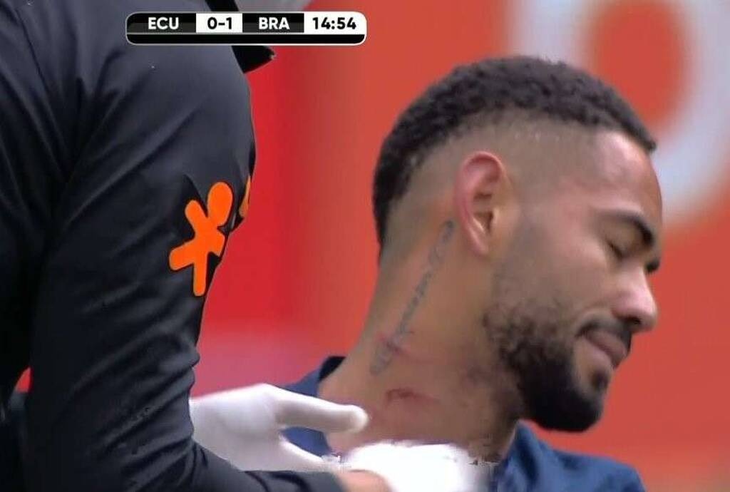 Βραζιλία: Ο… σημαδεμένος Κούνια (Photos)