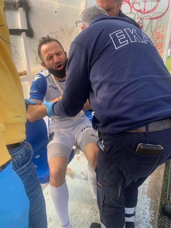 Σαντορίνη: Στο νοσοκομείο με κάταγμα ο Ιβανίδης (photos)