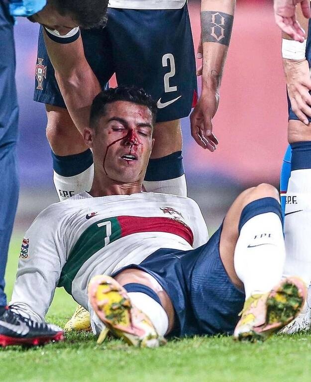 Nations League: Ο Βατσλίκ τραυμάτισε τον Κριστιάνο Ρονάλντο (Video+photos)