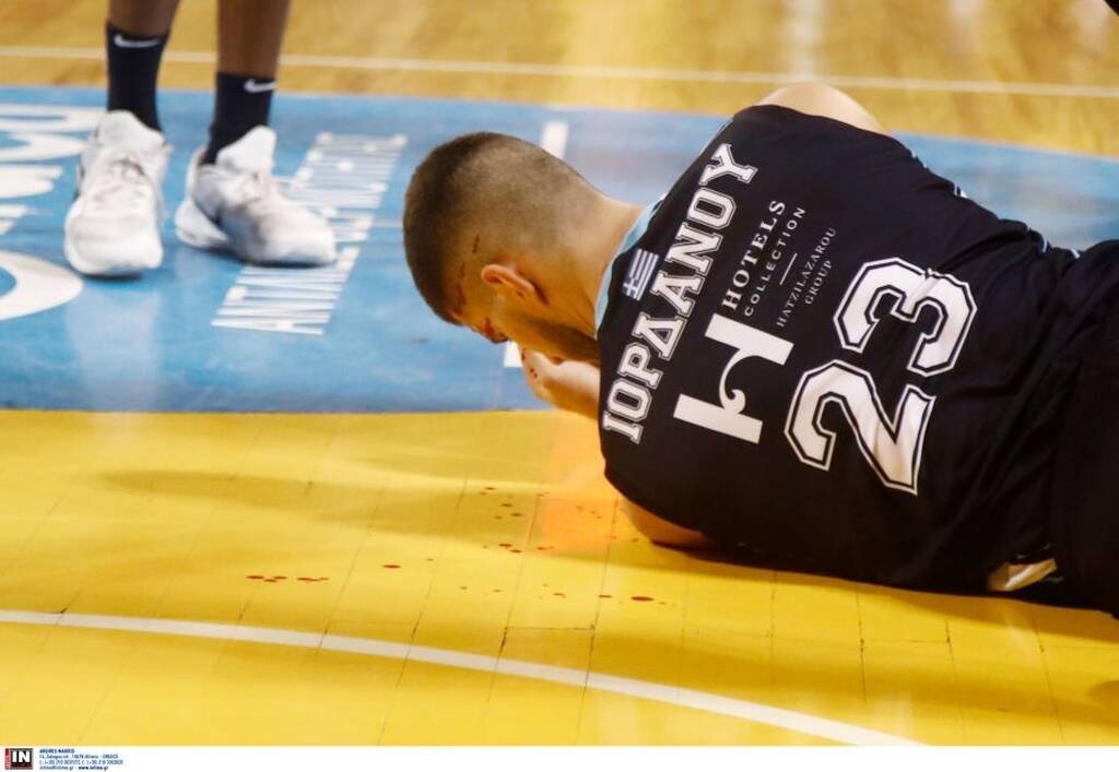 Άρης-Κολοσσός: Σοκαριστικός τραυματισμός, γέμισε αίματα το παρκέ (photos+video)