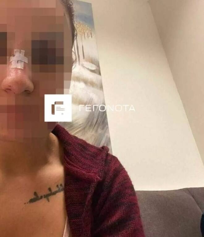 Βόλος: Διεθνής αθλητής κατηγορείται για τον ξυλοδαρμό της πρώην συζύγου του