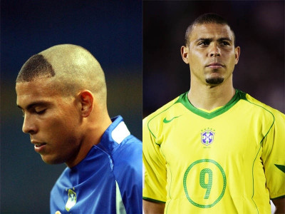 Το υπέρβαρο θαύμα...