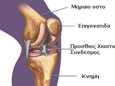 Αστάθεια της Επιγονατίδας