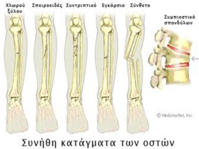 Αντιμετώπιση καταγμάτων