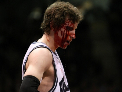 ΠΡΟΣΟΧΗ: Δαγκώνει!