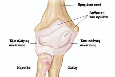 Ρευματοειδής Αρθρίτιδα