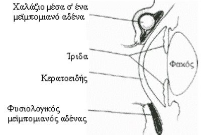 Χαλάζιο και κριθαράκι είναι το ίδιο πράγμα;