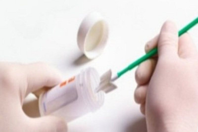 To ΠΑΠ Test δίνει τη σκυτάλη στο HPV Test