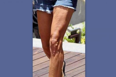 Και όμως… κάποτε ήταν top model!