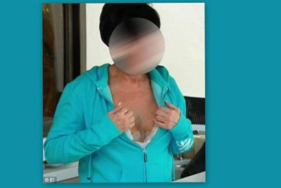 Γνωστή κυρία έδειξε τα εμφυτεύματα στήθους της (photos)