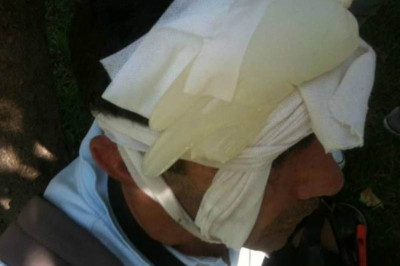 Τραυματίας δημοσιογράφος στο Σύνταγμα (φωτο)