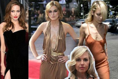 Οι ανησυχητικά αδύνατες celebrities