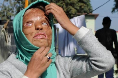 Η γυναίκα με το παραμορφωμένο πρόσωπο κέρδισε τον «εκατομμυριούχο»