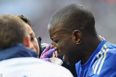 Τσέλσι: «Μασκοφόρος» Μπα