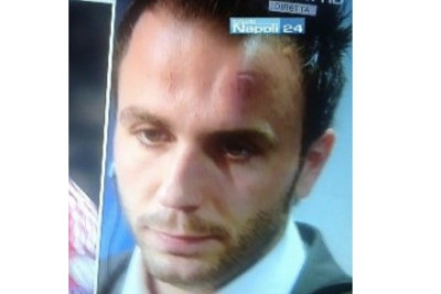 Μίλαν: Άφησε... καρούμπαλο στον Πατσίνι ο Πουγιόλ