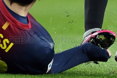 Μπαρτσελόνα: Να γιατί μάτωσε ο Μέσι! (photos)