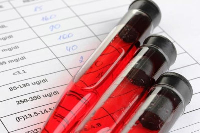 Εξέταση αίματος θα υπολογίζει το προσδόκιμο ζωής