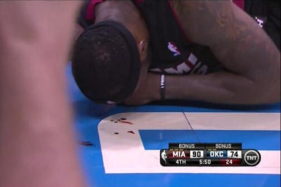 Ματωμένος θρίαμβος για Τζέιμς