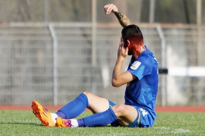 Πιερικός-Ηρακλής: Ο σοκαριστικός τραυματισμός του Ζιαμπάρη (photos+video)