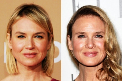 Renee Zellweger: Ευθύνεται ο Κρόνος που έγινε αγνώριστη από τις πλαστικές;